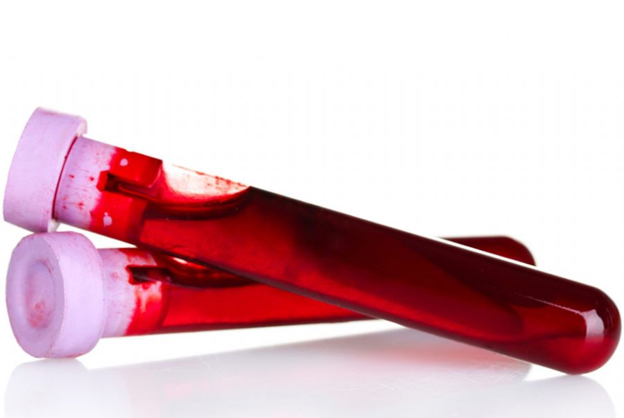 A determinação do grupo Rh na prevenção da doença hemolítica do recém ...